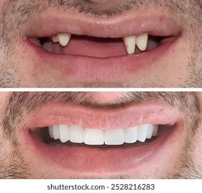 Illustrative smile restoration
