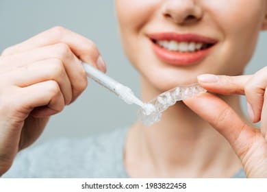 Home whitening trays